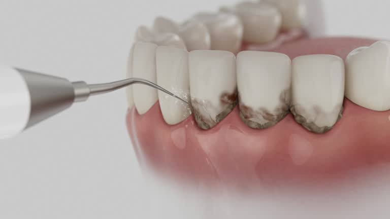 Trusted Teeth Cleaning And Checkup service in East Oakdale, CA - Dentist Open Now